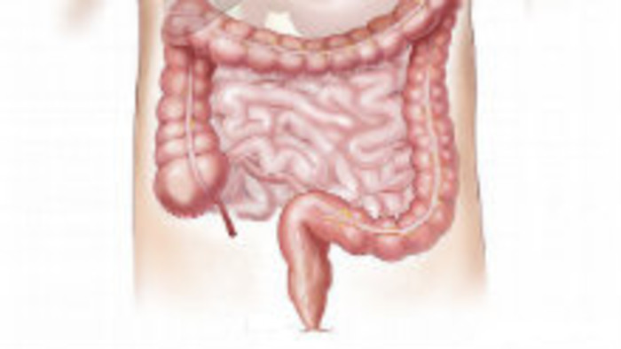 Ústna baktéria v hrubom čreve
