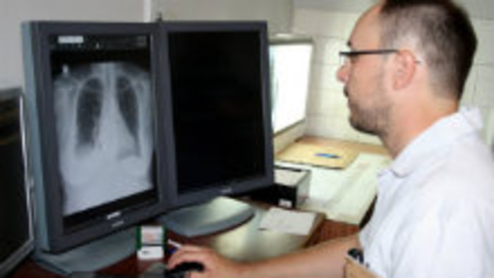 Aké majú možnosti malí pacienti na rádiológii?