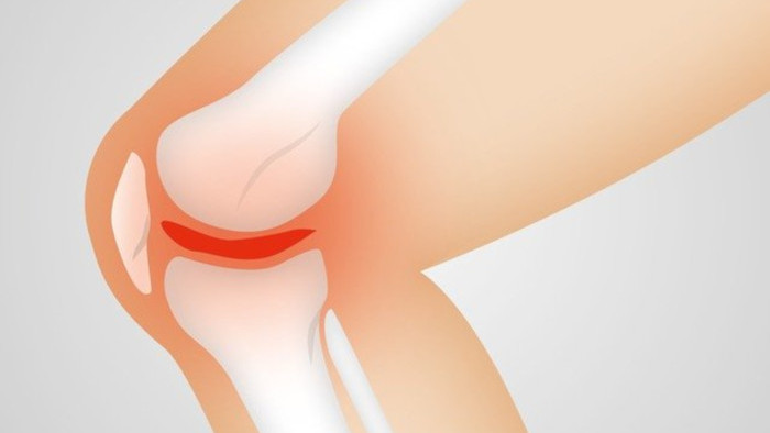 Artroskopia kolena