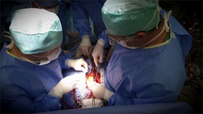  Transplantácie vlani zachránili 181 životov 